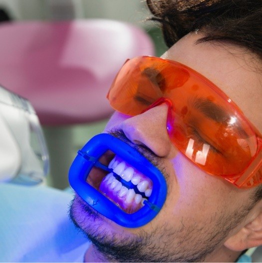 Man getting professional teeth whitening from his cosmetic dentist in Dallas