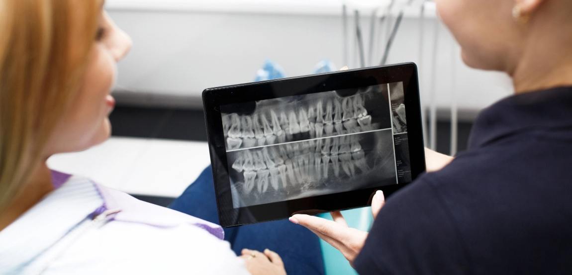 Dallas emergency dentist showing a patient x rays of their teeth